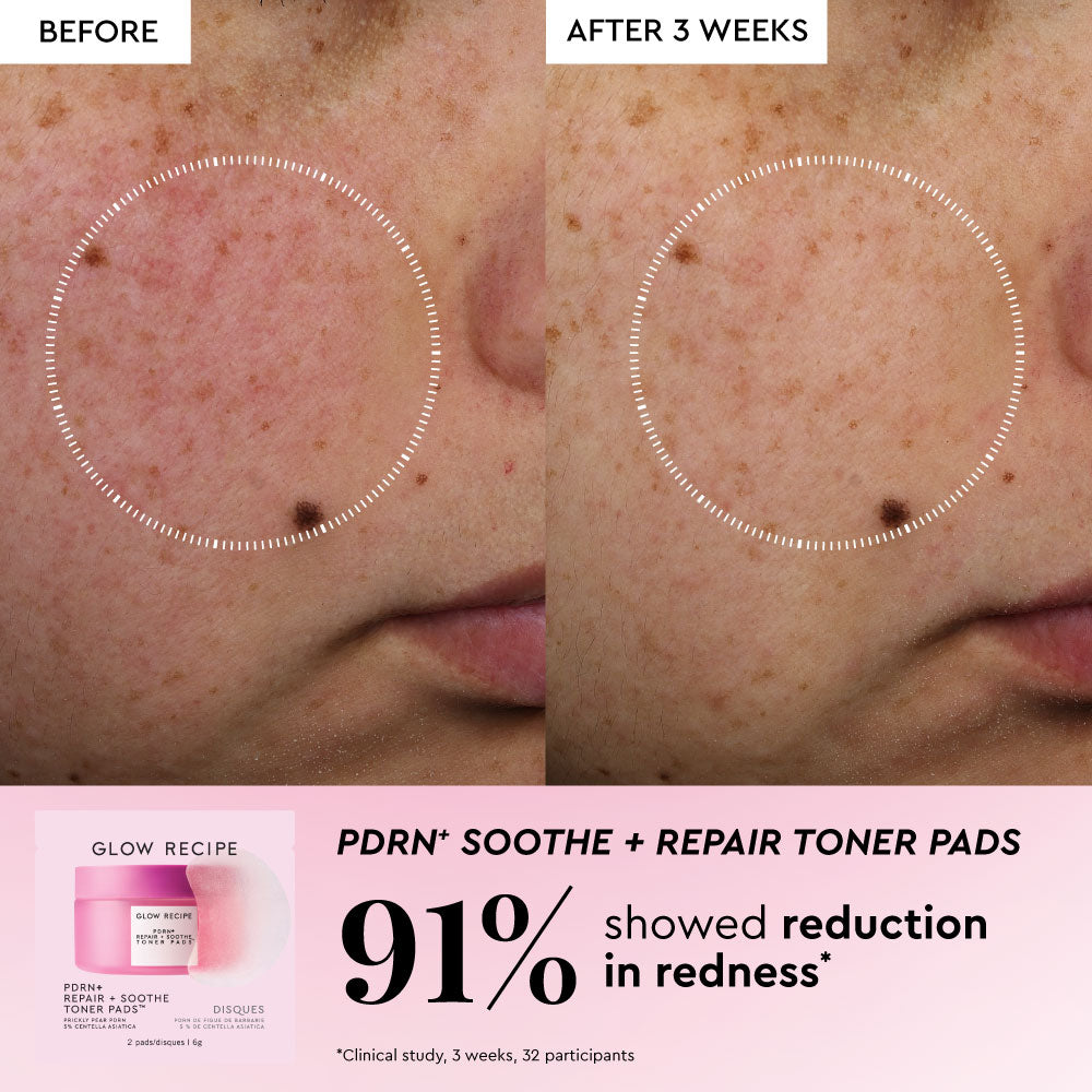 Glow Recipe Koreya Toner Pad Dəri Qulluğu Komplekti Gözenəklər, Tünd Ləkələr və Dəri Baryeri Onarışı üçün