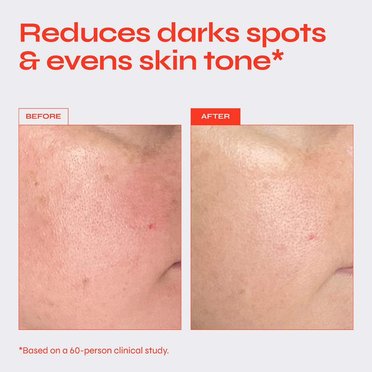 Facile Brighten Niasinamid 5% Serumu Tünd Ləkələr və Bərabərsiz Dəri Quruluşu Üçün