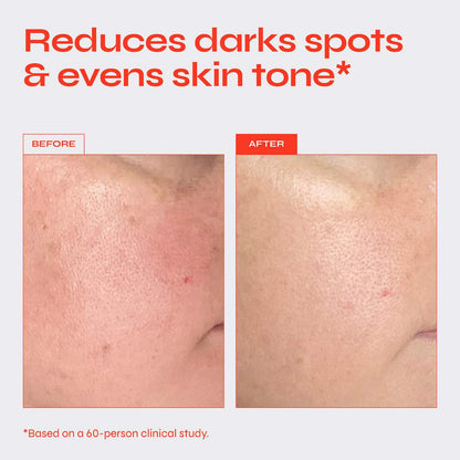 Facile Brighten Niasinamid 5% Serumu Tünd Ləkələr və Bərabərsiz Dəri Quruluşu Üçün
