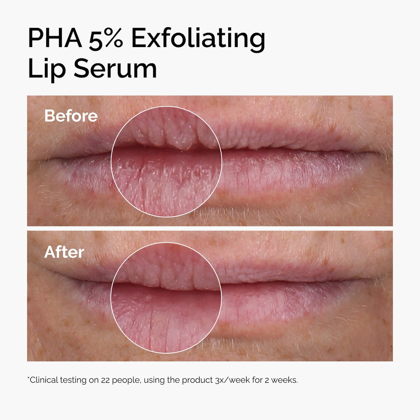 The Ordinary PHA 5% Eksfoliyant Dodaq Serumu