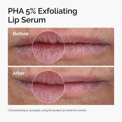 The Ordinary PHA 5% Eksfoliyant Dodaq Serumu