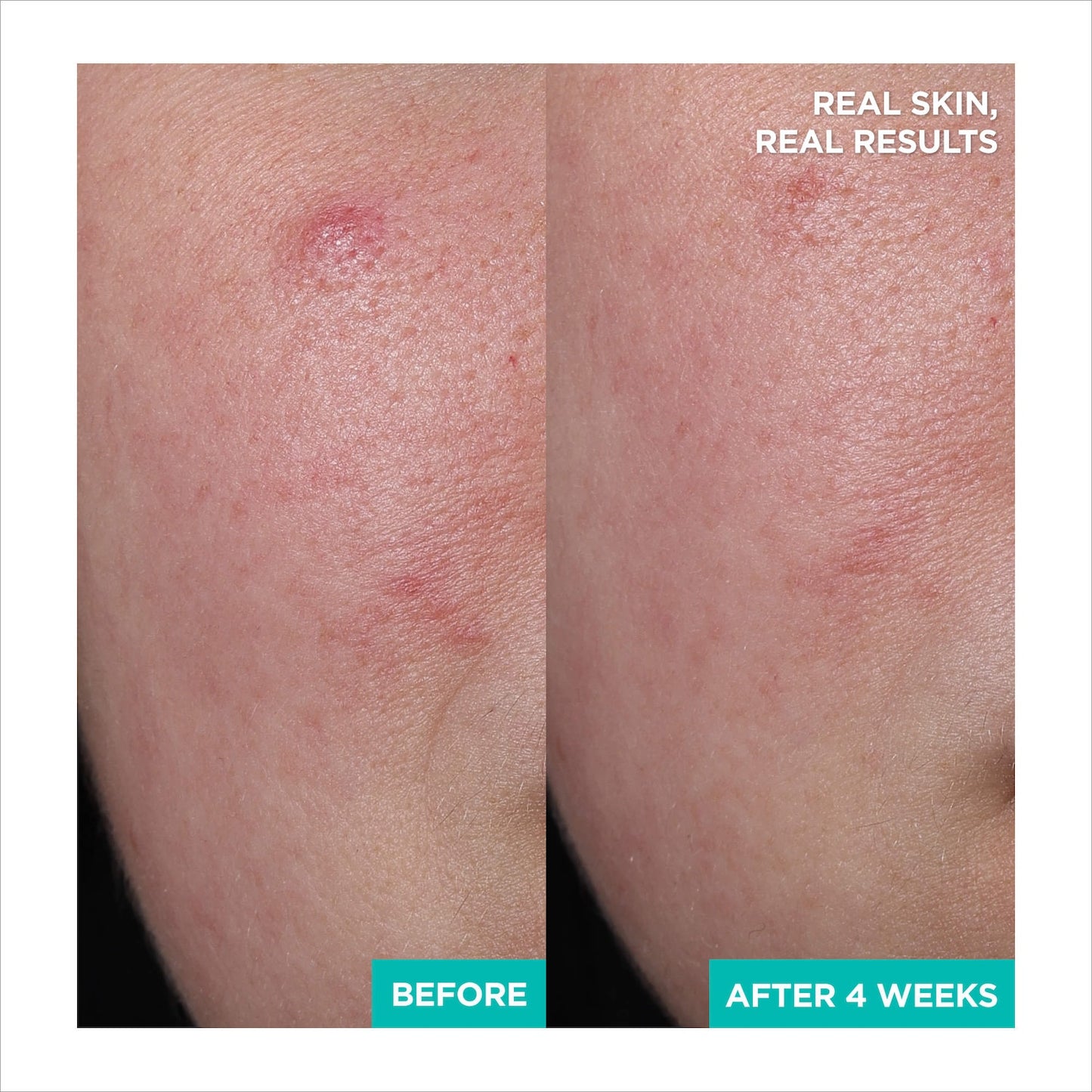 AESTURA A-CICA365 Yatışdırıcı Onarıcı Gel Krem Nəmləndirici pH4.5 Centella Asiatica və Panthenol ilə
