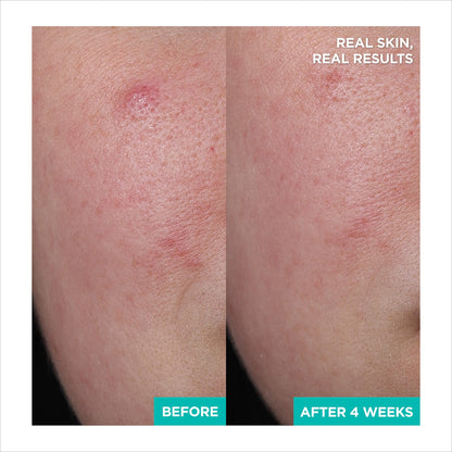 AESTURA A-CICA365 Yatışdırıcı Onarıcı Gel Krem Nəmləndirici pH4.5 Centella Asiatica və Panthenol ilə