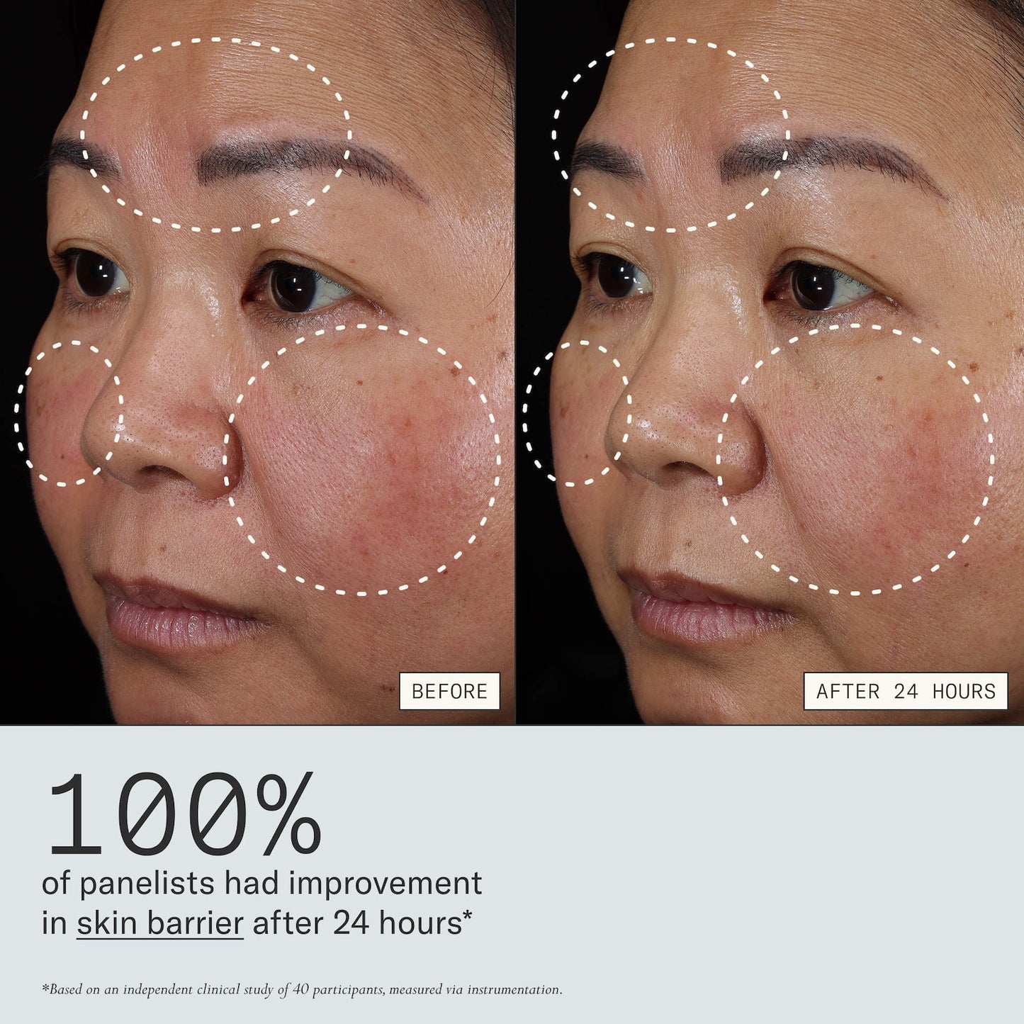 Dieux Instant Angel Lipid-Rich Firming Moisturizer