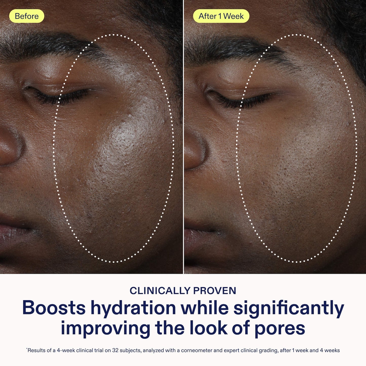 Skinfix Barrier Balancing Water Cream Nəmləndirici Kremi Hialuron Turşusu ilə