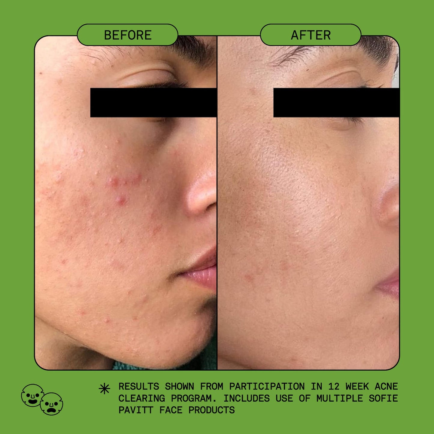 SOFIE PAVITT FACE Clean Nəm Və Yumuşaq Gel Köpük Üz Yuma Vasitəsi