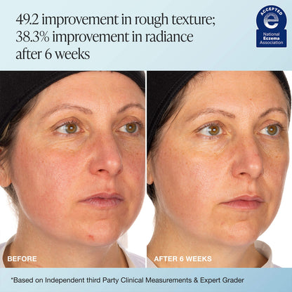 INNBEAUTY PROJECT Recharge Gel Cream Hamarlanma və Şişirtici Nəmləndirici Krem
