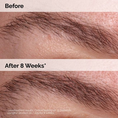 The Ordinary Multi-Peptide Kirpik və Qaş Serumu - 0.16 fl oz