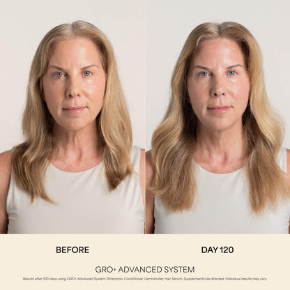 Vegamour GRO+ Advanced Balanslaşdırıcı Saç Balzamı İncə Saçlar Üçün