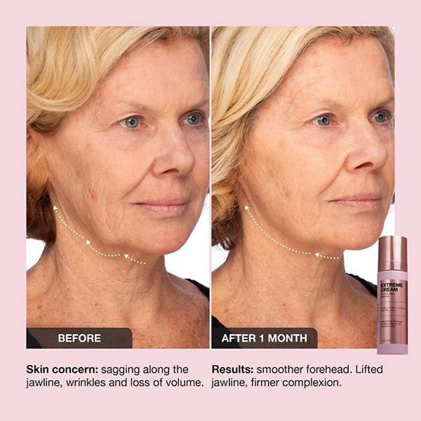 iNNBEAUTY PROJECT Extreme Cream Yaşlanma Əleyhinə Sıkılaşdırıcı və Liftinq Nəmləndirici Krem