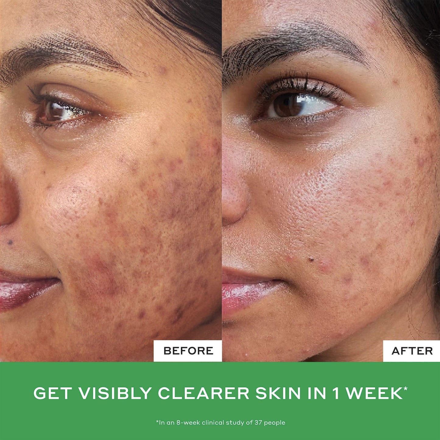 OLEHENRIKSEN Daily D-Clog Səbətləşən Salisilik Asid Üz Yuma Vasitəsi
