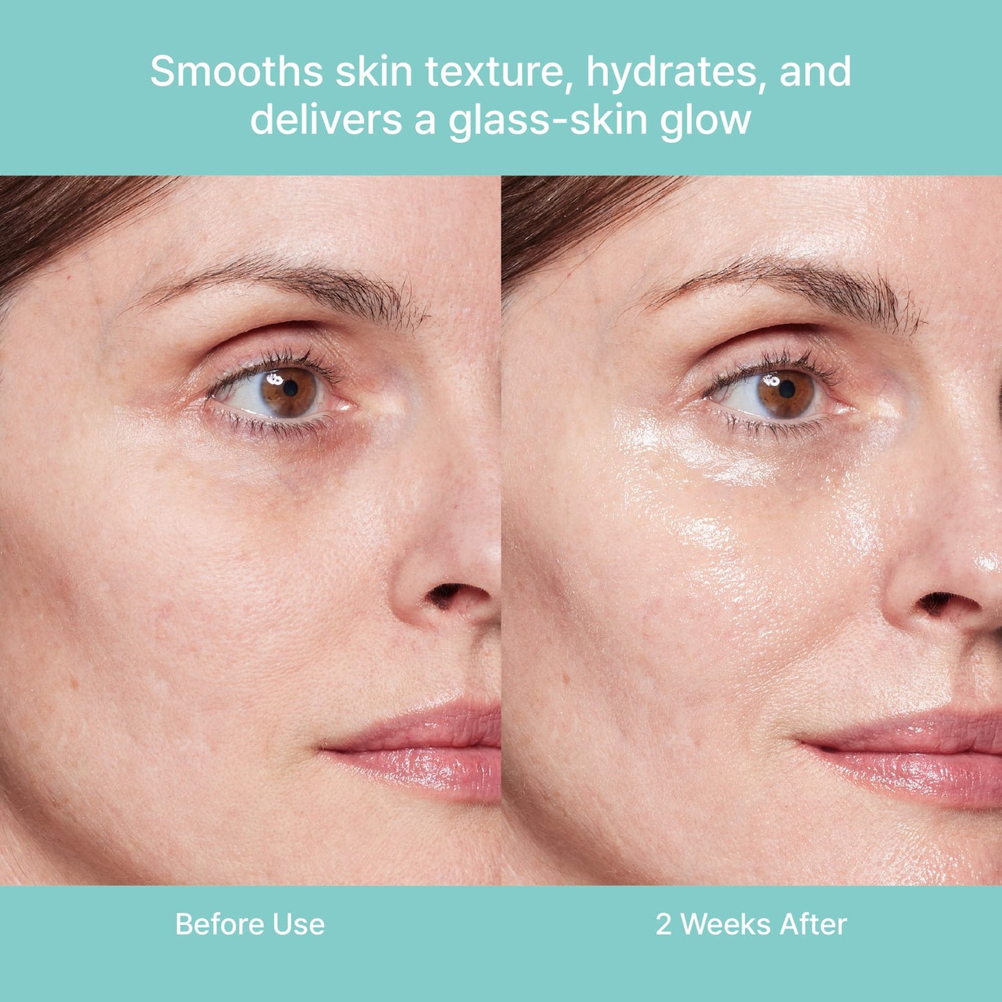 Rejuran Turnover Ampoule c-PDRN® 0.5% Yeniləyici Serum