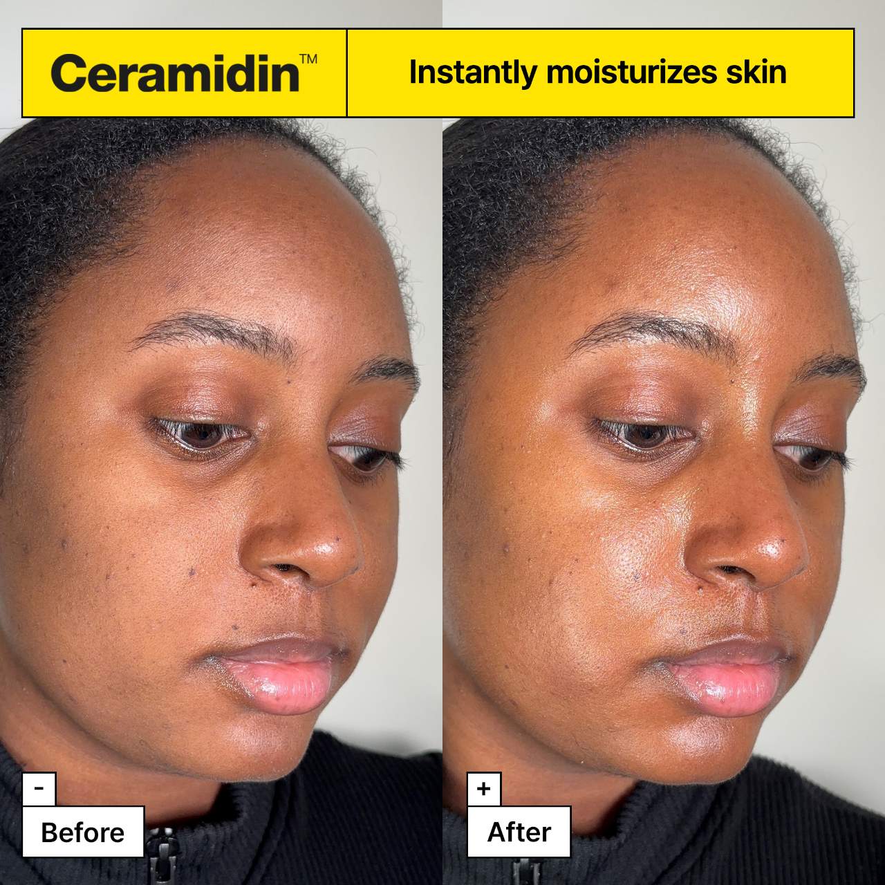 Dr. Jart+ Ceramidin™ Dəri Maneəsi Nəmləndirici Kremi