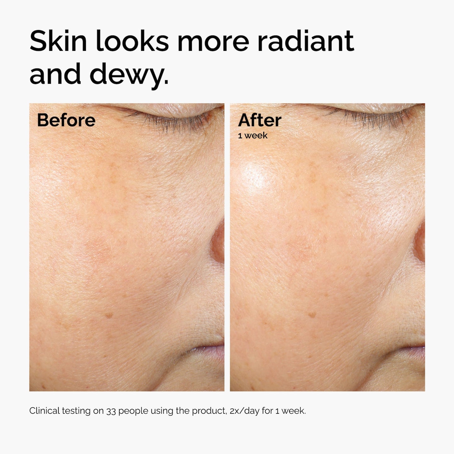 The Ordinary Düyü Lipidləri + Ektoin Mikroemulsiyonu Yatışdırıcı Nəmləndirici Krem