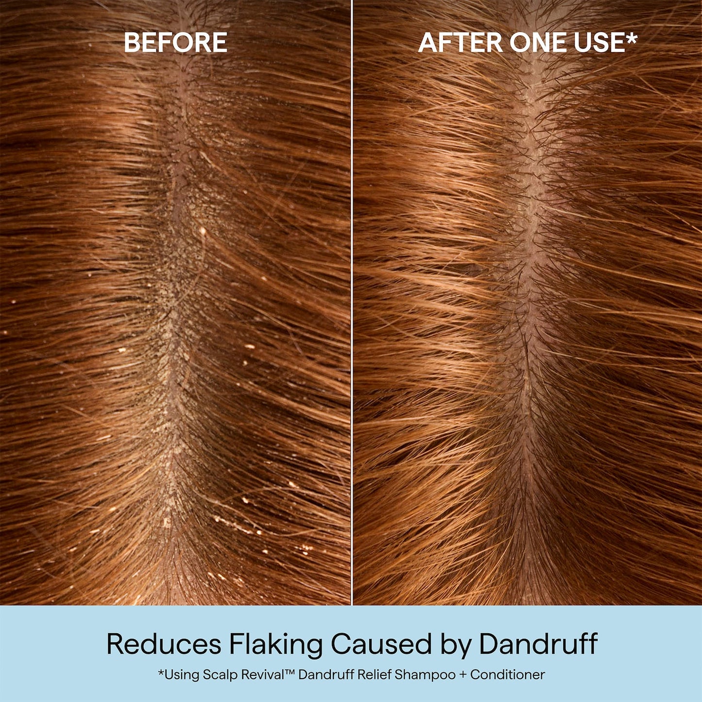 Briogeo Scalp Revival™ Kəpəkli Saçlar Üçün Şampun Salisilik Turşu ilə