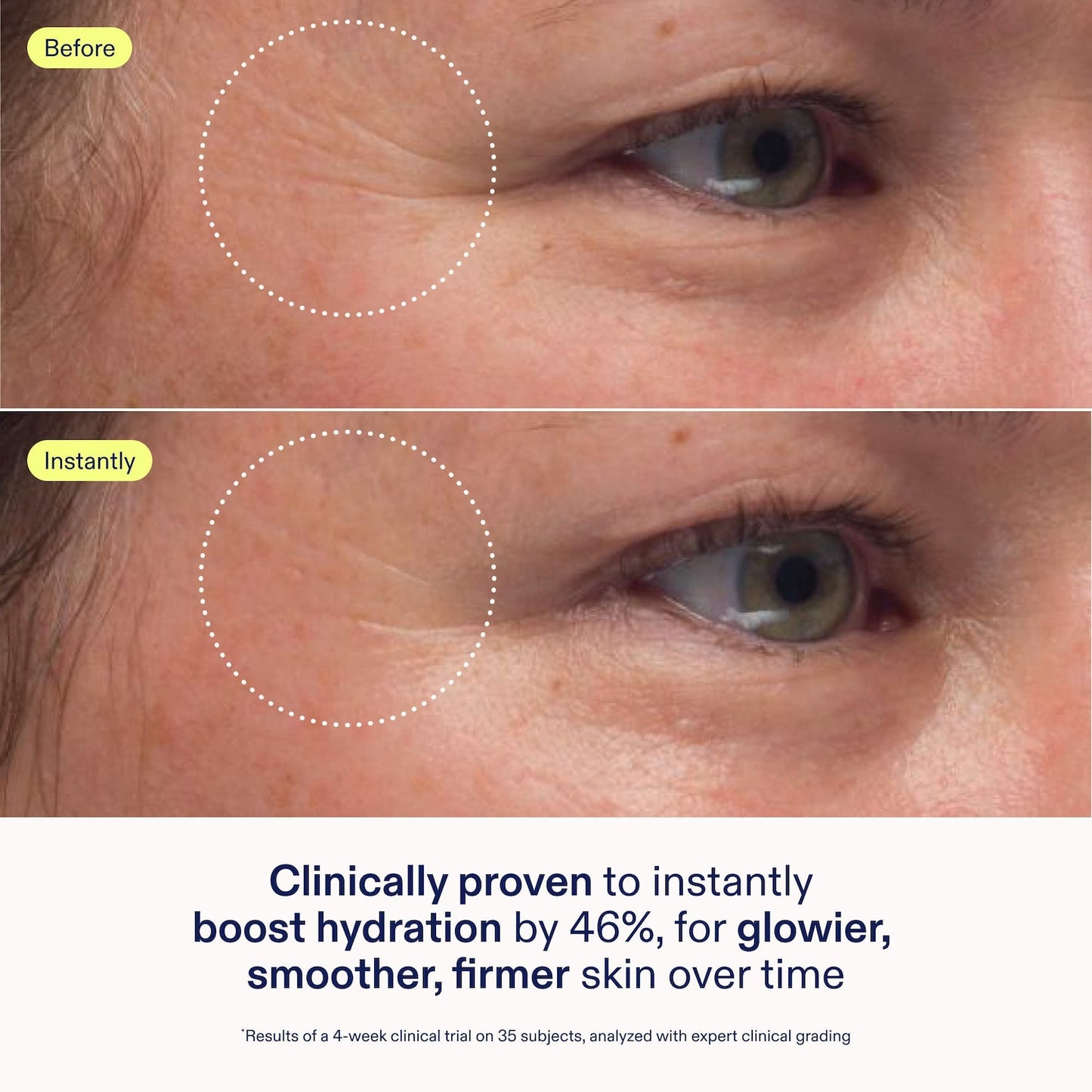 Skinfix Mini Triple Lipid-Peptid Kremi Doldurulabilir Baryera Nəmləndirici Seramidlərlə