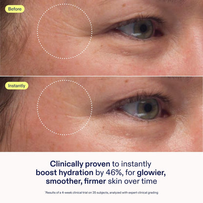 Skinfix Mini Triple Lipid-Peptid Kremi Doldurulabilir Baryera Nəmləndirici Seramidlərlə