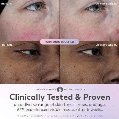 Olay Super Face Serum with Vitamin C - 1 fl oz: Deri Tonunun Yaxşılaşdırılması, Sıklaştırma, Nemləndirmə, İnce Xətlərin Azaldılması YoxYox