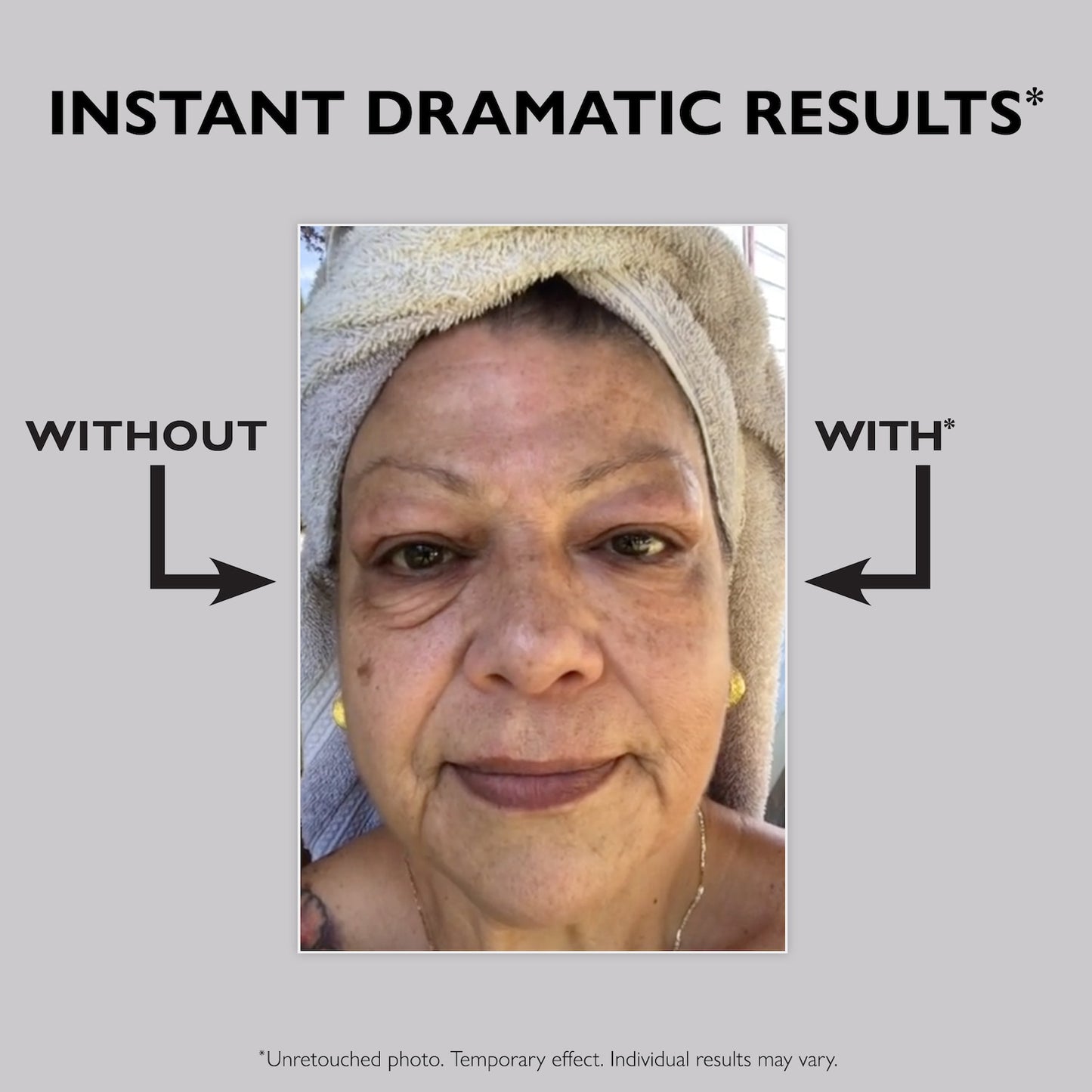 Peter Thomas Roth Instant FIRMx® Eye Dərhal Göz Sıxlaşdırıcısı
