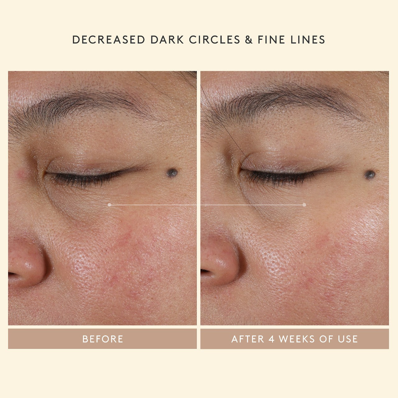 Shani Darden Skin Care Sıkılaştırıcı Peptidlərlə Intensiv Göz Yeniləmə Kremi