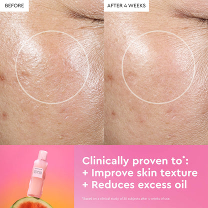 Glow Recipe Qarpız Parıltısı PHA + BHA Gözenek Sıxlaşdırıcı Tonik