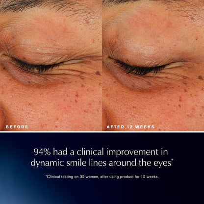 Estée Lauder Advanced Night Repair Göz Lifti + Sculpt Göz Kremi