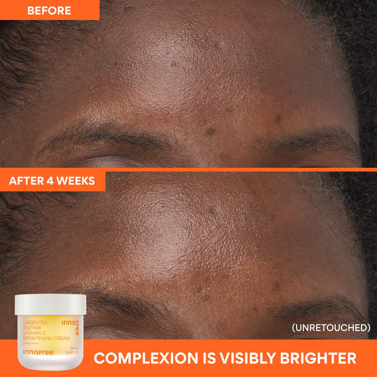 innisfree C Vitamini Parlaqlıq Verici Doldurula Bilən Gel Krem Nemləndirici Krem Tünd Ləkələr Üçün
