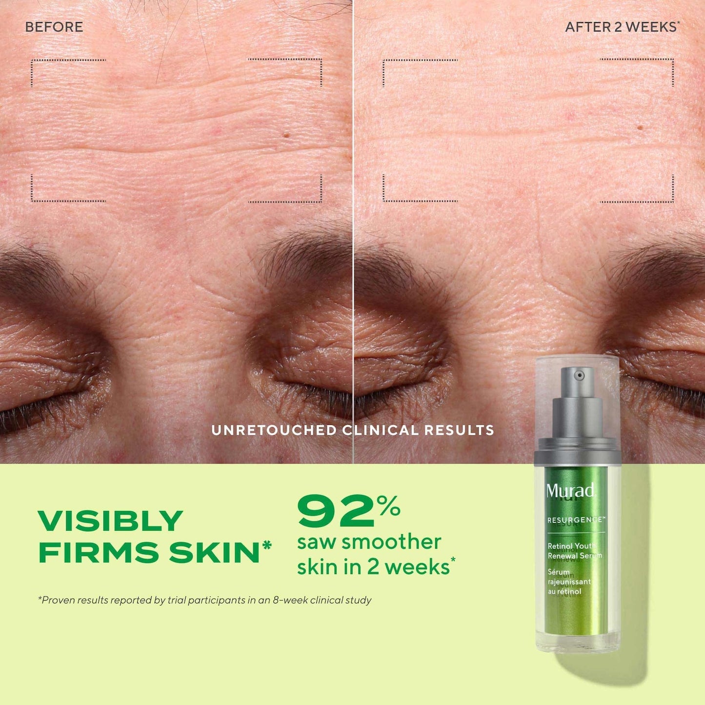 Murad Retinol Gənclik Yeniləməsi Sıyırma və Hamarlaştırma Serumu Hialuron Turşusu ilə