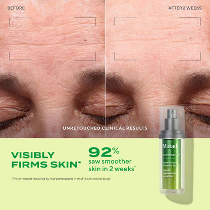 Murad Retinol Gənclik Yeniləməsi Sıyırma və Hamarlaştırma Serumu Hialuron Turşusu ilə
