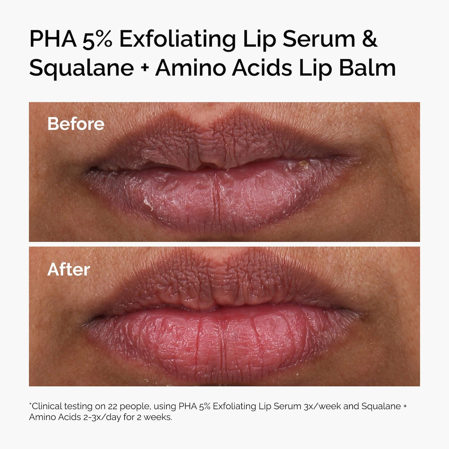 The Ordinary PHA 5% Eksfoliyant Dodaq Serumu