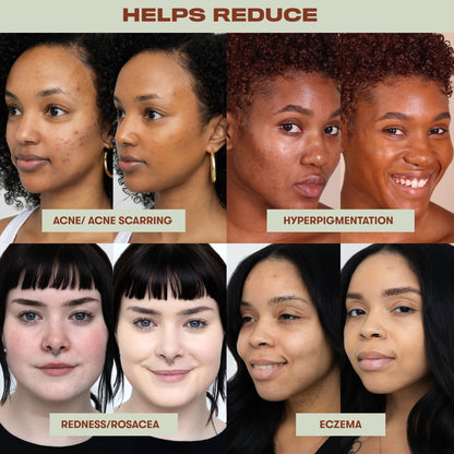 Range Beauty True Intentions Dərinin Rahatlığı Üçün Nəmləndirici Tonal Krem