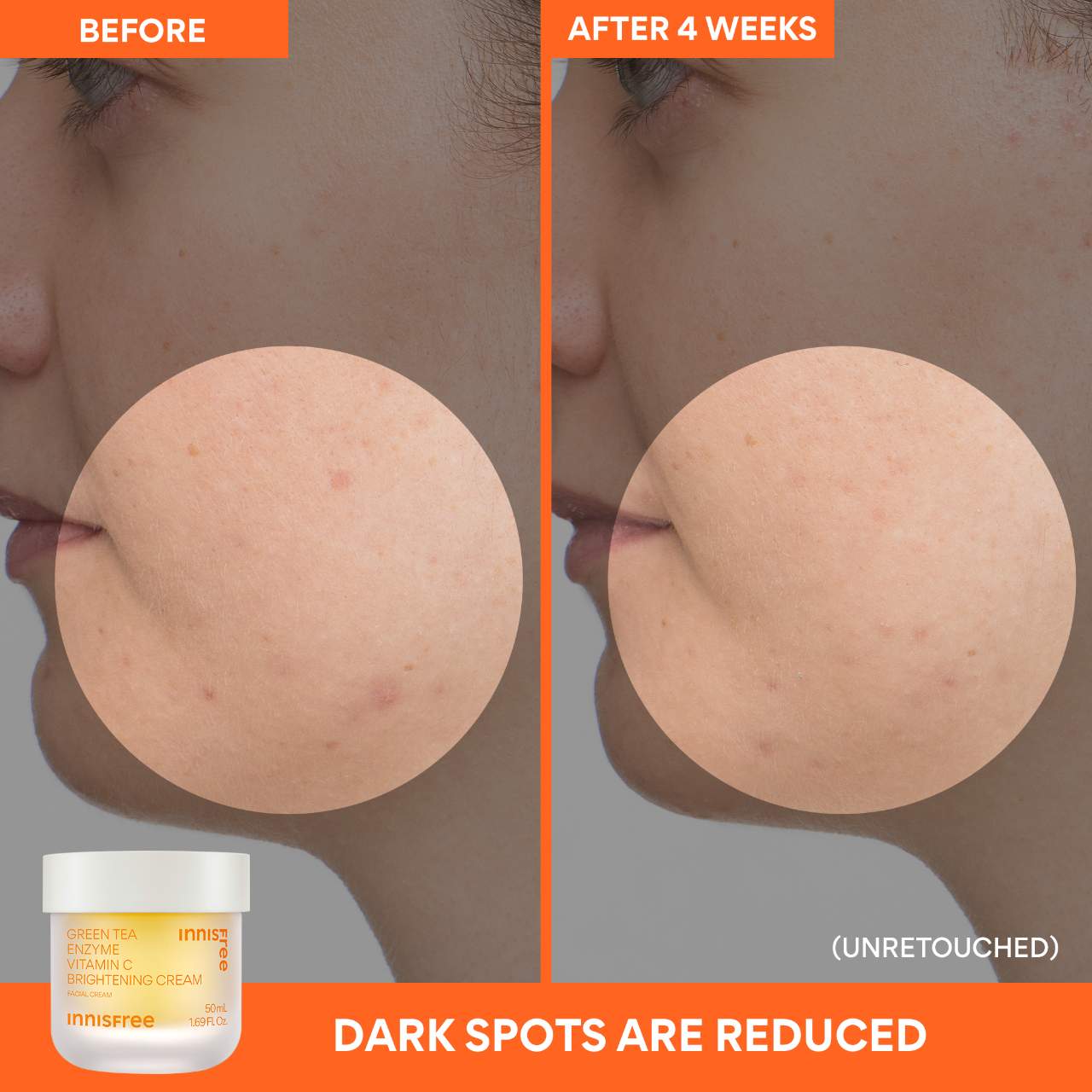 innisfree C Vitamini Parlaqlıq Verici Doldurula Bilən Gel Krem Nemləndirici Krem Tünd Ləkələr Üçün