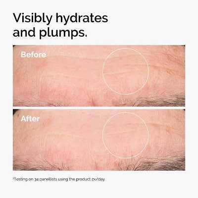 The Ordinary Hialuron Turşusu 2% + B5 Nemləndirici Serum Keramidlərlə - 1 fl oz - Ulta Beauty: Yağsız, Vegan, Normal Quru Dəri üçün