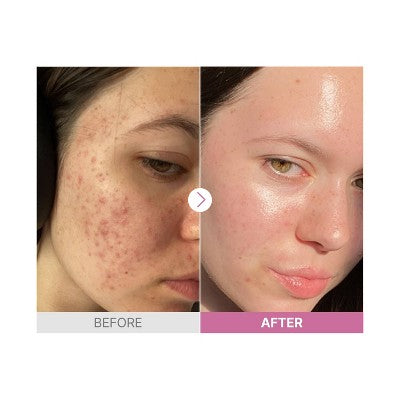 COSRX The Niacinamide 15 Üz Serumu - 20ml