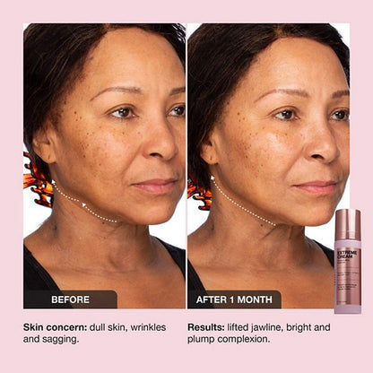 iNNBEAUTY PROJECT Extreme Cream Yaşlanma Əleyhinə Sıkılaşdırıcı və Liftinq Nəmləndirici Krem