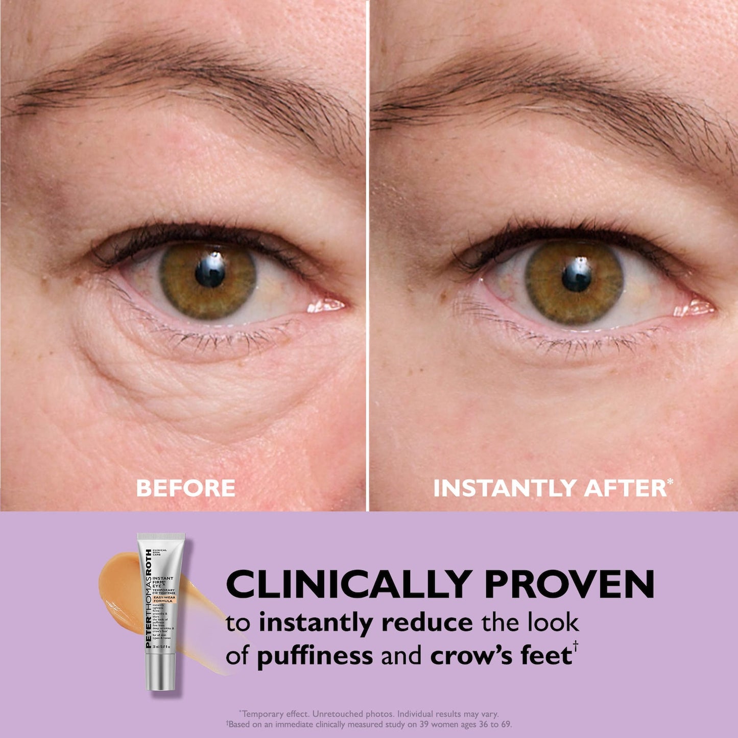 Peter Thomas Roth Instant FIRMx® Eye Göz Altı Sıkılaştırıcı Krem