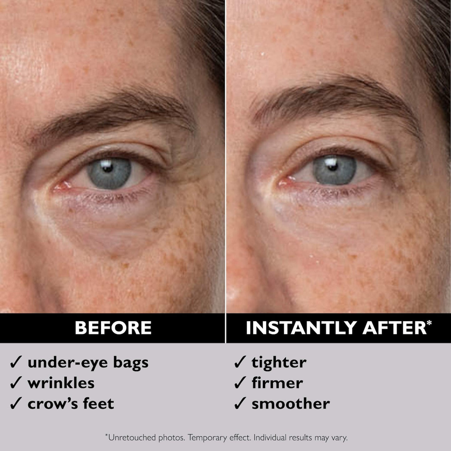 Peter Thomas Roth Instant FIRMx® Eye Dərhal Göz Sıxlaşdırıcısı