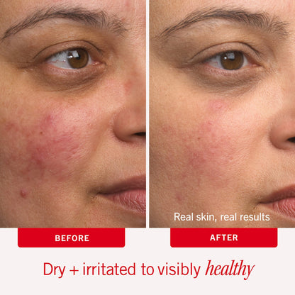 First Aid Beauty Ultra Repair® Kremi Intensiv Nemləndirmə – Üz və Bədən Nəmləndirici Kremi