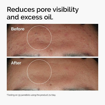 The Ordinary Niacinamide 10% + Zinc 1% - 30ml - Yağsız, Vegan, Həssas Dəri üçün Uyğun