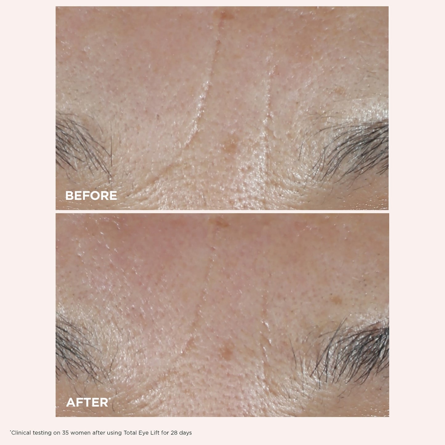 Clarins Total Eye Lift Göz Kremi - Səhvlik, Qırışqalar və Tünd Hələlər üçün