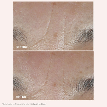 Clarins Total Eye Lift Göz Kremi - Səhvlik, Qırışqalar və Tünd Hələlər üçün