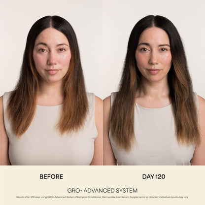 Vegamour GRO+ Advanced Balanslaşdırıcı Saç Balzamı İncə Saçlar Üçün