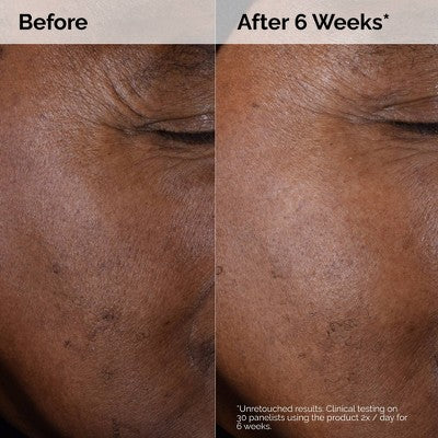 The Ordinary Glikolik Asit 7% Eksfoliant və Parlaqlıq Günlük Toneri - 8 fl oz