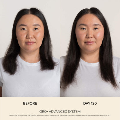 Vegamour GRO+ Advanced Balanslaşdırıcı Saç Balzamı İncə Saçlar Üçün