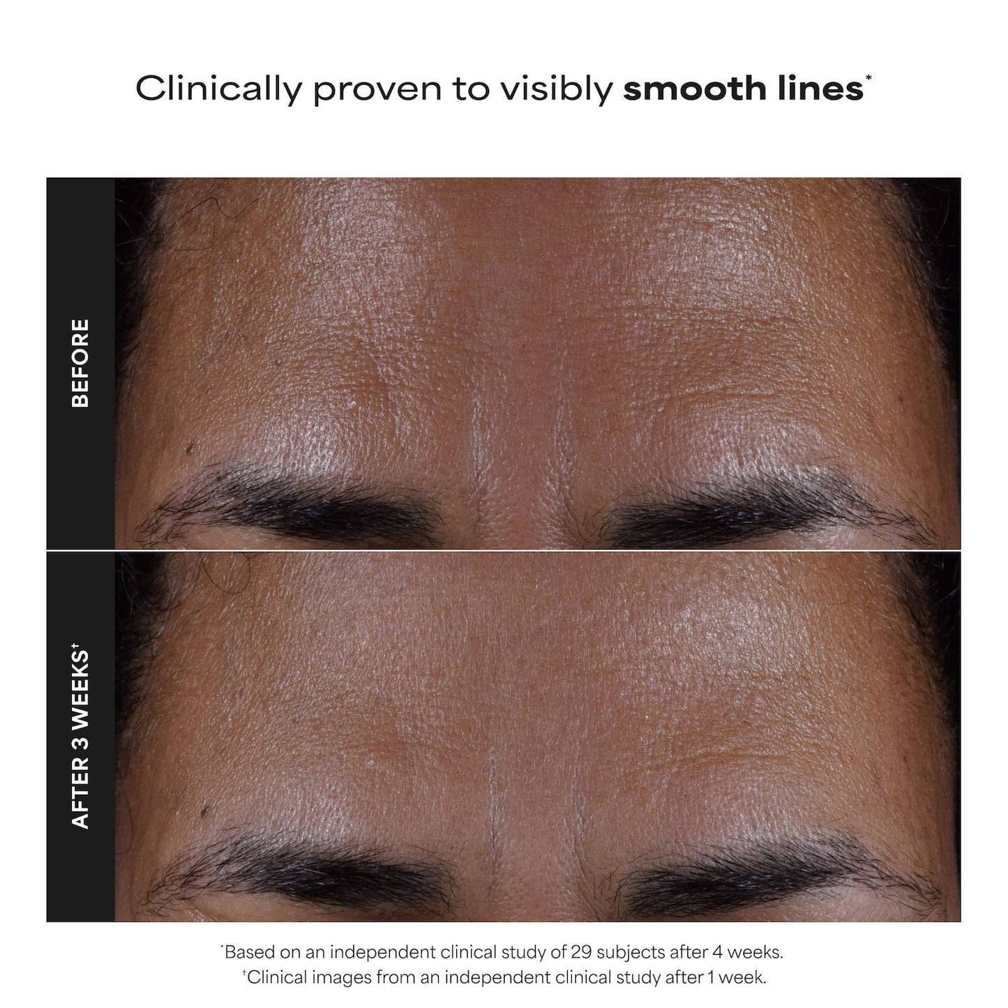 Paula's Choice Dəri Mükəmməlləşdirici 2% BHA Eksfoliant Tonik