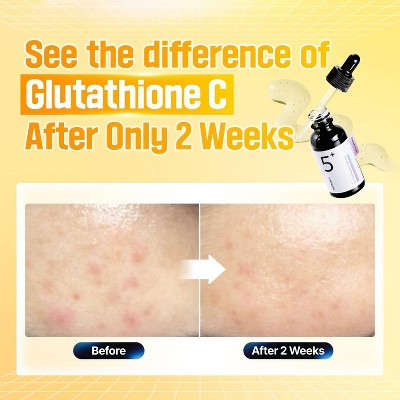 numbuzin No.5+ Glutatyon Vitamin Konsentrat Üz Serumu - Səyahət Ölçüsü - 1.01 fl oz: Qaranlıq Ləkə Azaldılması, Parlaqlıq, E və C Vitamini İçərir YoxYox