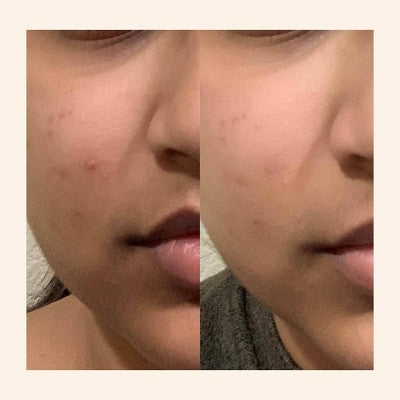 Peach & Lily Glass Skin Refining Serum 1.35 fl oz - Möhürləndirici, Parlatıcı, Nəmləndirici, Yatışdırıcı Serum