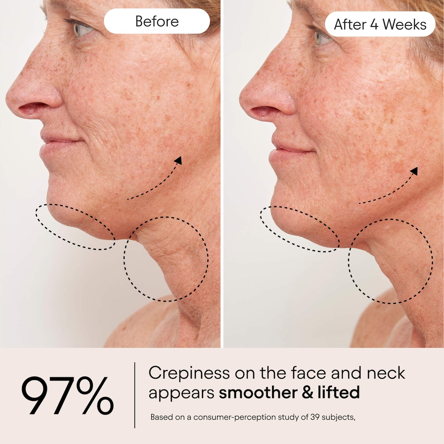 ALPYN Super Sculpt Peptid Möhkəmləndirici və Lifting Serumu Üz, Boyun və Dekoltе üçün