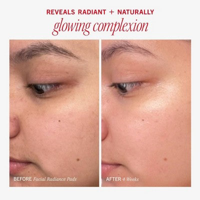 FIRST AID BEAUTY Həssas və Normal Dəri üçün Zərif Eksfoliyant Üz Pətləkləri - Ətrsiz - 28ct