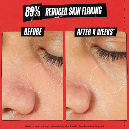 Kiehl's Since 1851 Ultra Facial Meltdown Recovery Dərmatoloji Krem Kolloidal Ovamalla